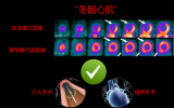 朱元凯，成钊汀，朱小华：《“洞若观火”—— 核医学显像洞见心肌的“黑洞”》