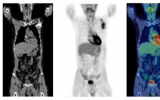 英国专家发布2022 PET/CT使用指南